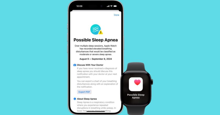 Apple Watch: Alvászavar és szív egészség funkciók szélesebb körben